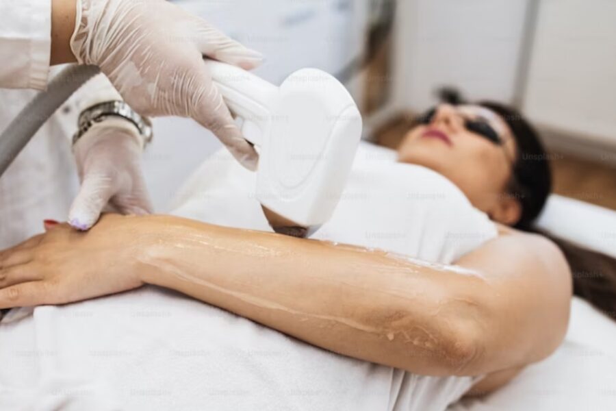 epilare definitivă cu laser - cum să ai grijă de piele după